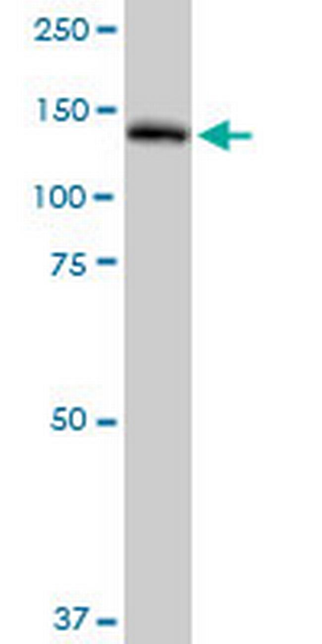 PLCG2 Antibody in Western Blot (WB)