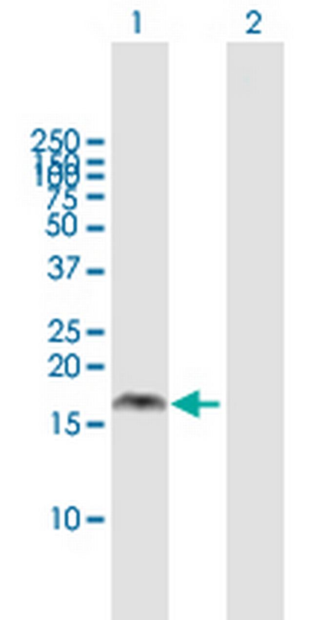 PMAIP1 Antibody in Western Blot (WB)