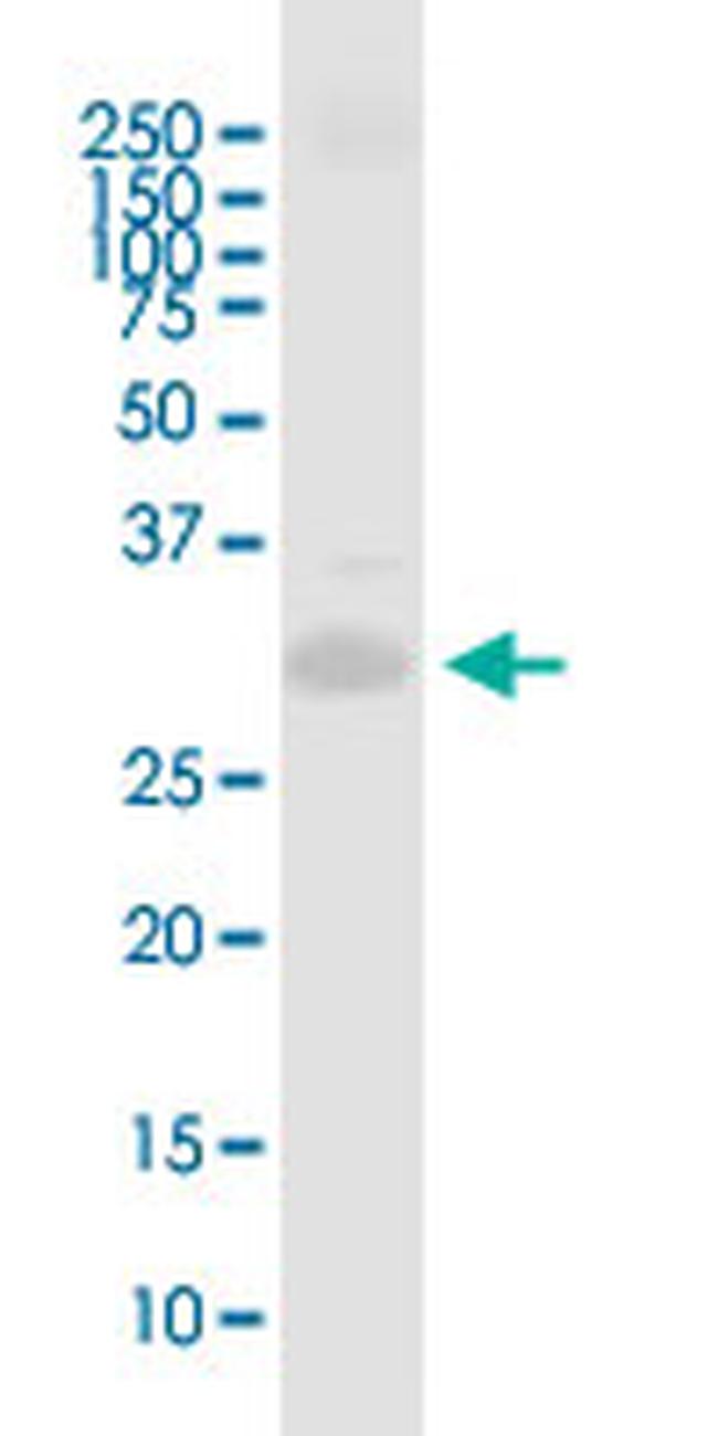 PRRX1 Antibody in Western Blot (WB)