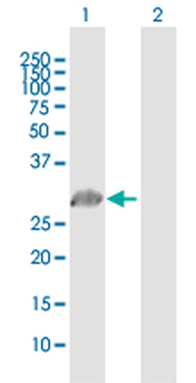 PRRX1 Antibody in Western Blot (WB)