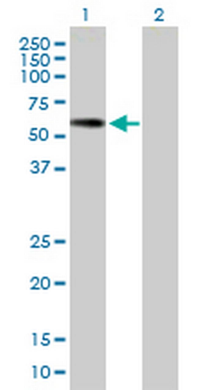 PNLIPRP2 Antibody in Western Blot (WB)