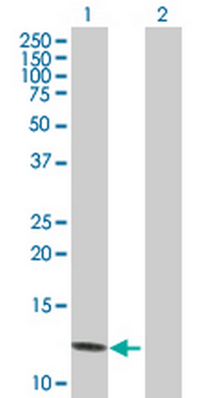 PPBP Antibody in Western Blot (WB)