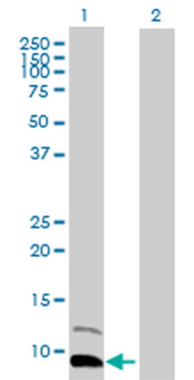 PPBP Antibody in Western Blot (WB)