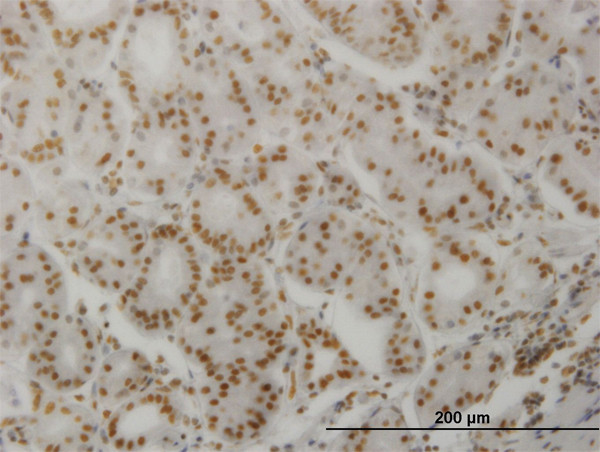 PPP3CA Antibody in Immunohistochemistry (Paraffin) (IHC (P))