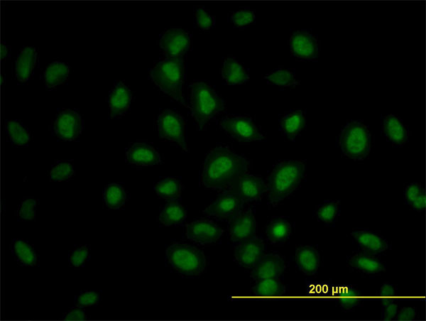 PRKAA1 Antibody in Immunocytochemistry (ICC/IF)