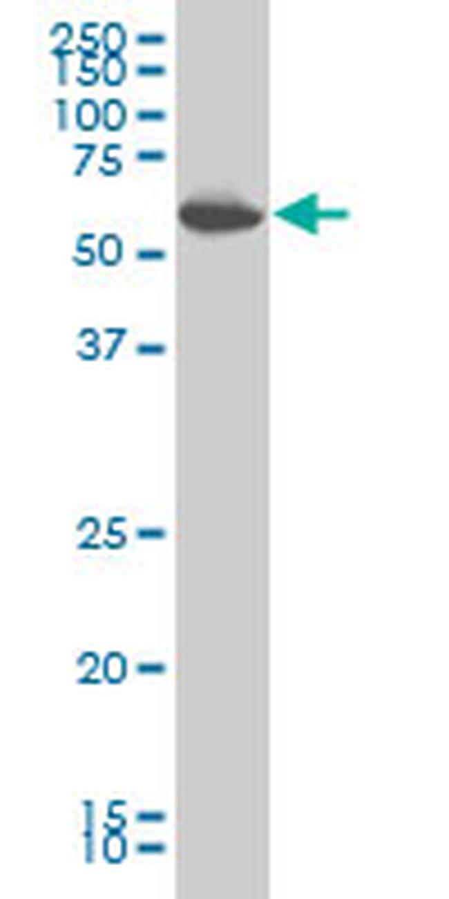 PRKAA1 Antibody in Western Blot (WB)