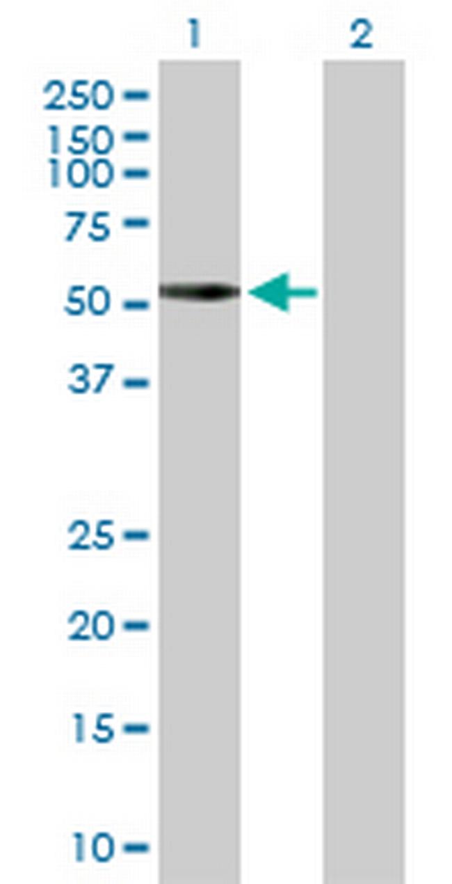 PRKACA Antibody in Western Blot (WB)