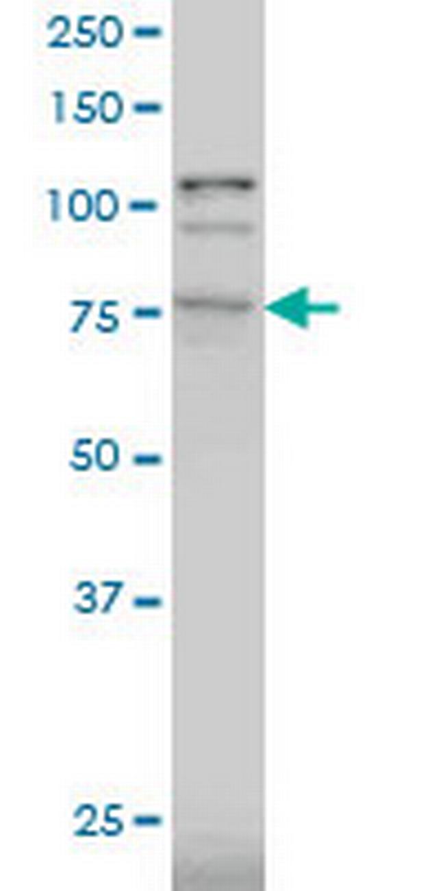 PRKCD Antibody in Western Blot (WB)