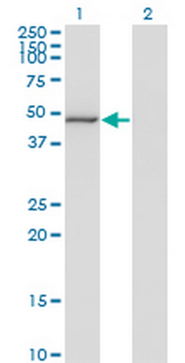 MAPK8 Antibody in Western Blot (WB)