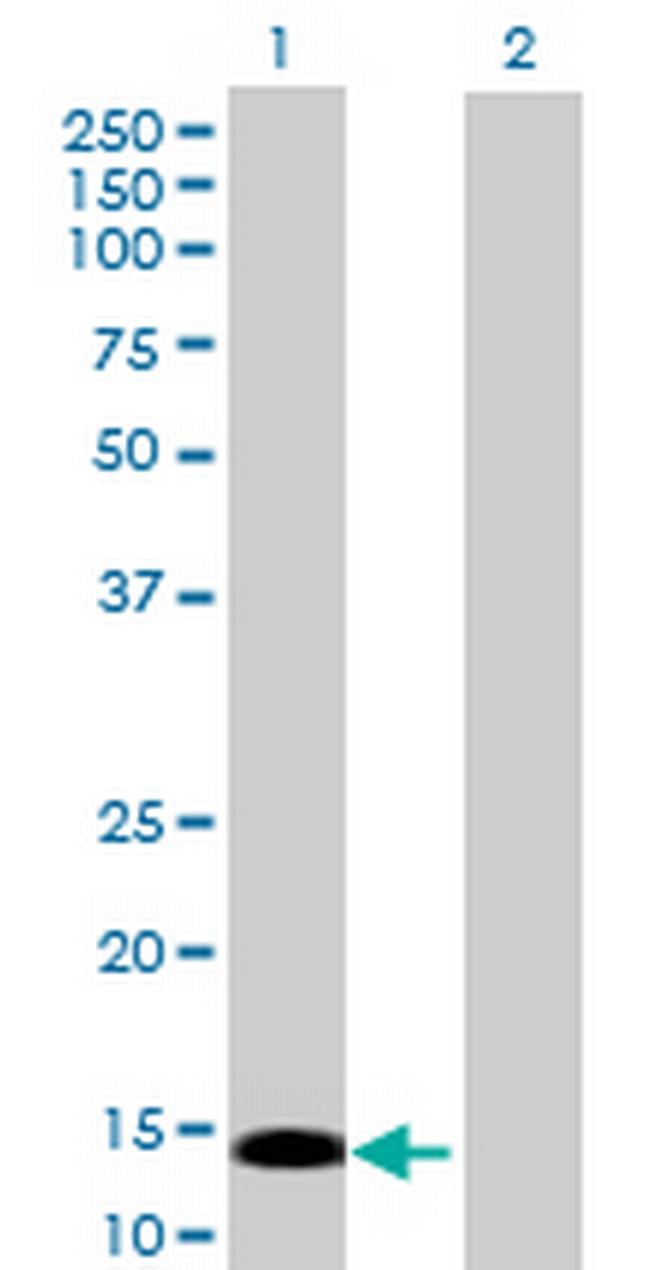 PRKRIR Antibody in Western Blot (WB)