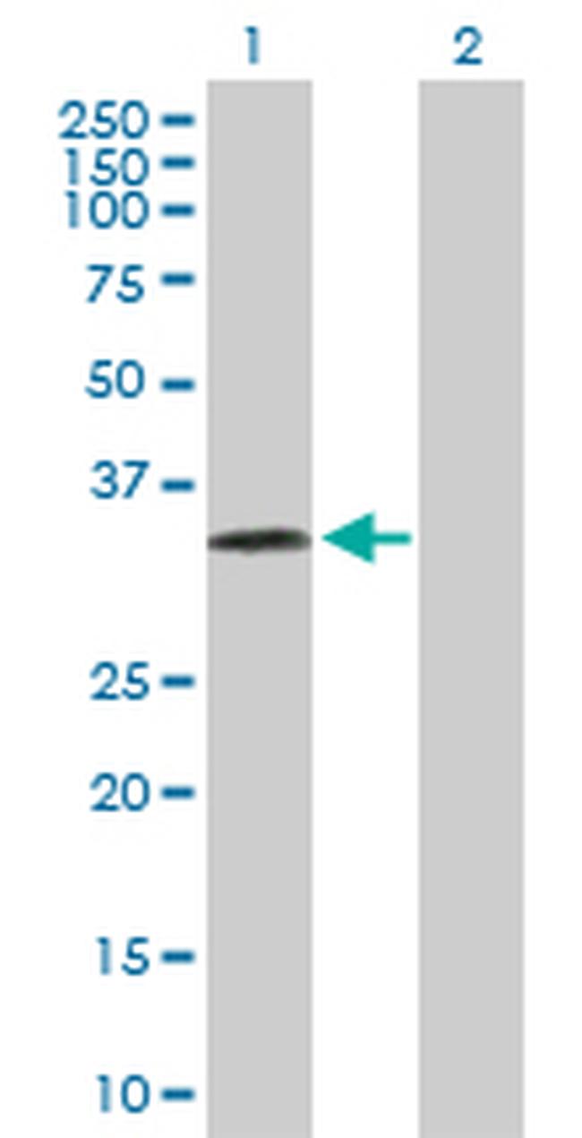 PRSS8 Antibody in Western Blot (WB)