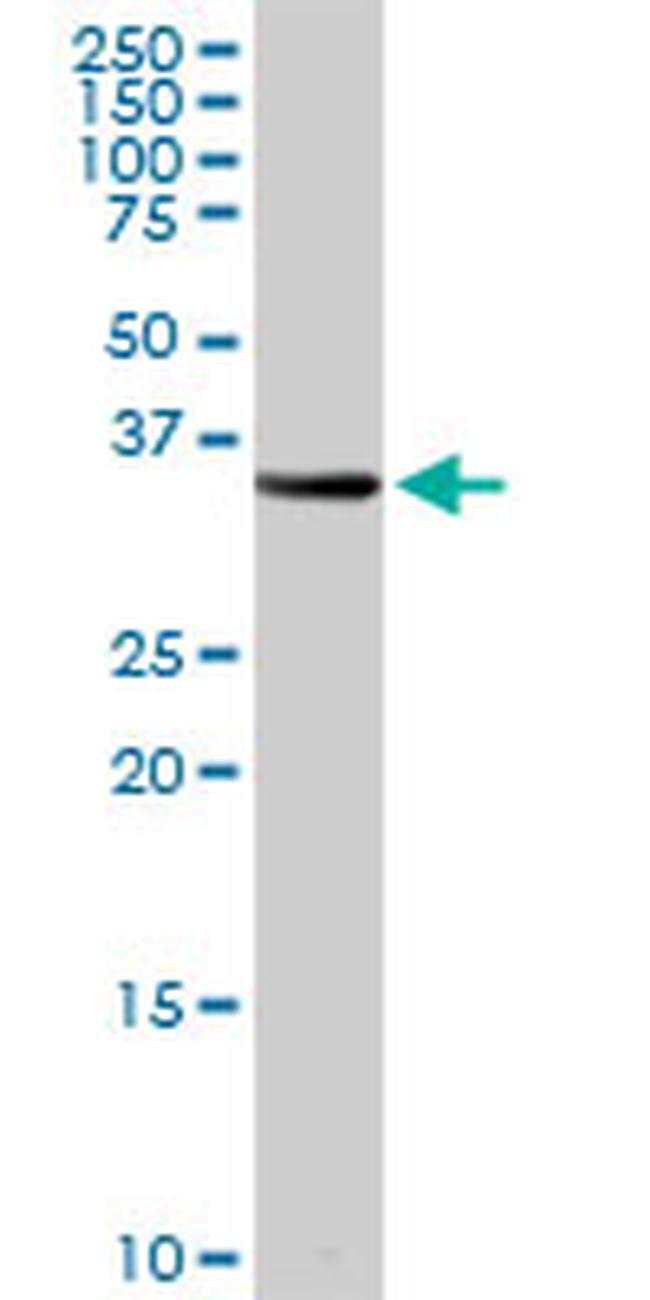 PSMB8 Antibody in Western Blot (WB)