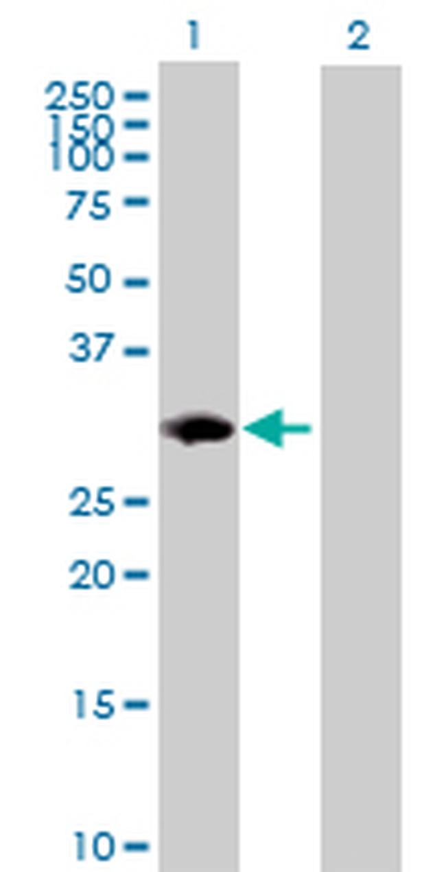 PSMB8 Antibody in Western Blot (WB)