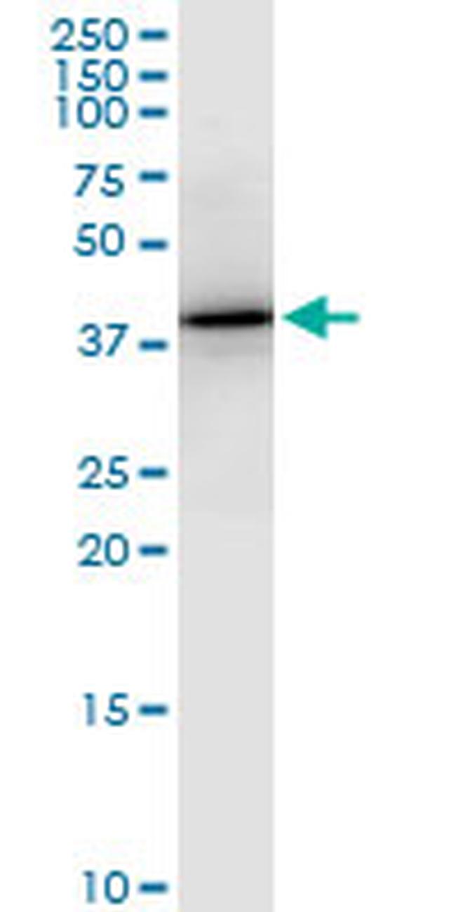 PTX3 Antibody in Western Blot (WB)