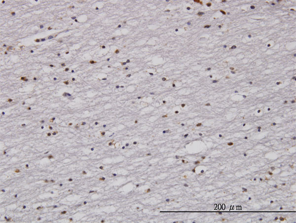 RAD1 Antibody in Immunohistochemistry (Paraffin) (IHC (P))