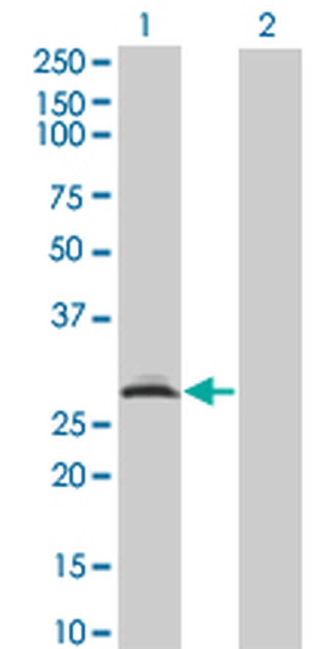 RAD1 Antibody in Western Blot (WB)