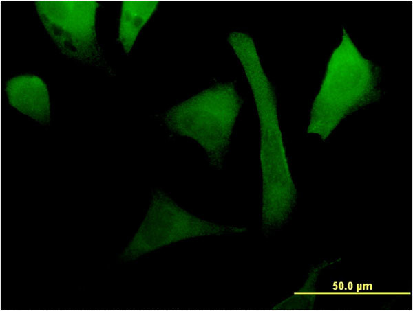 RAC2 Antibody in Immunocytochemistry (ICC/IF)