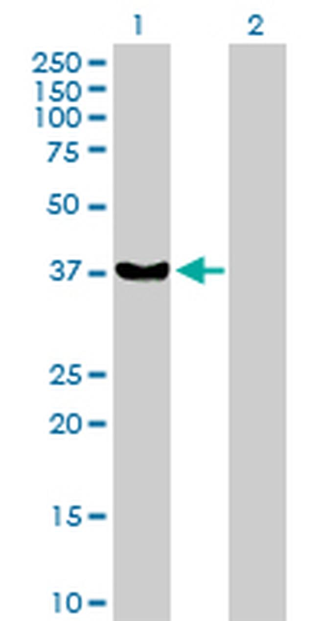 RAD51 Antibody in Western Blot (WB)