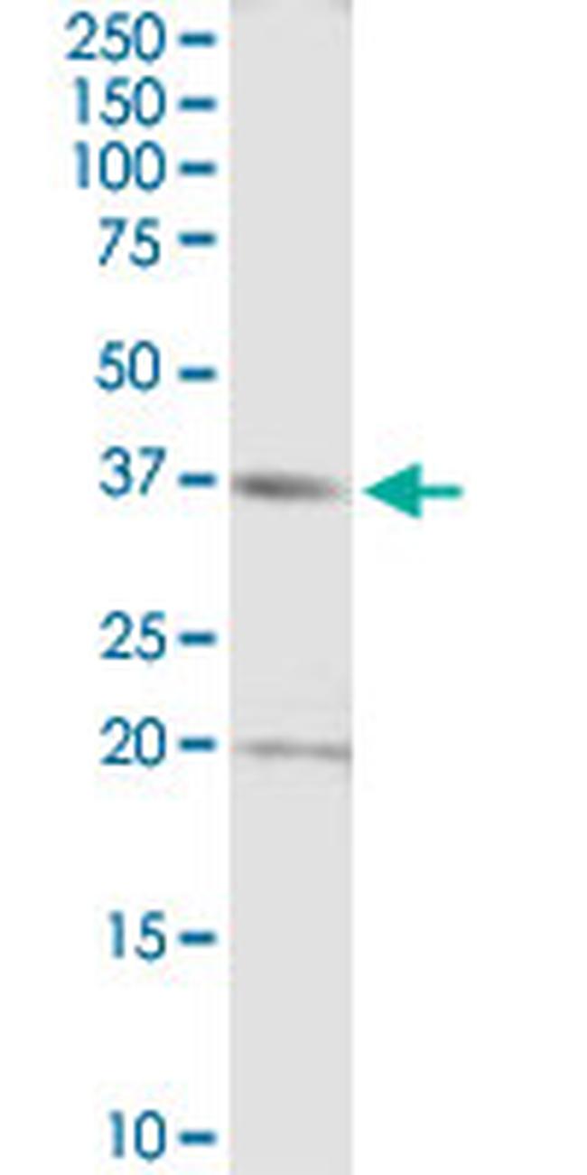 RAD51 Antibody in Western Blot (WB)