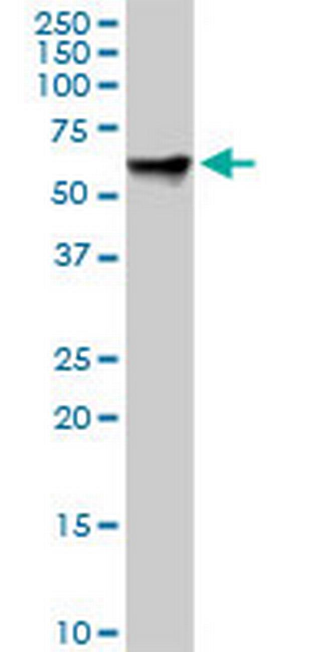 RDX Antibody in Western Blot (WB)