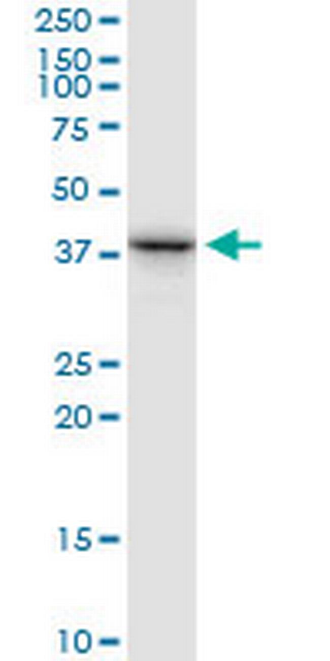 RFC3 Antibody in Western Blot (WB)