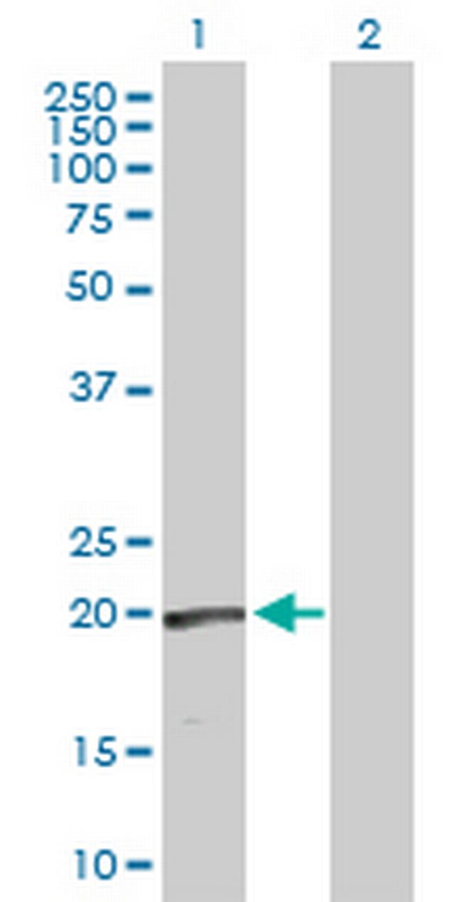 RLN1 Antibody in Western Blot (WB)