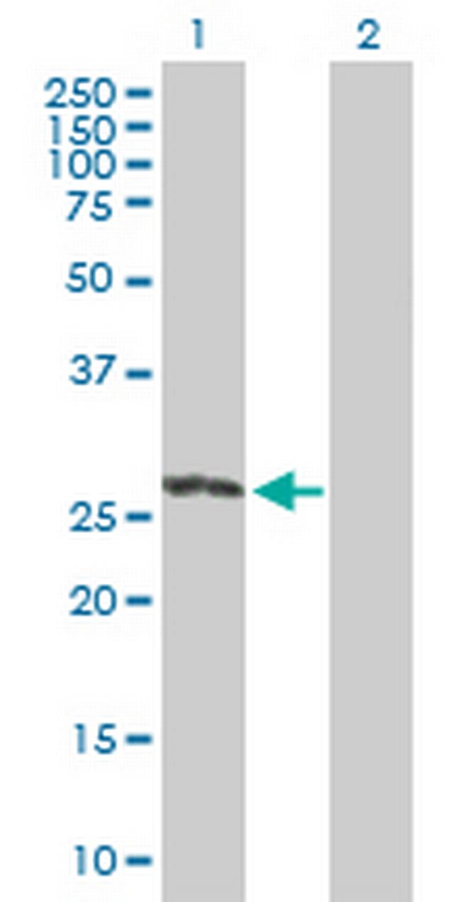 RIT2 Antibody in Western Blot (WB)