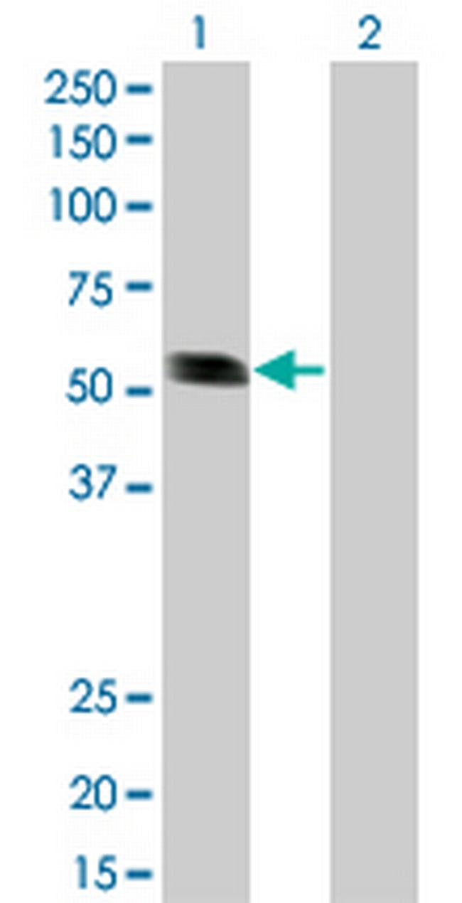 RING1 Antibody in Western Blot (WB)