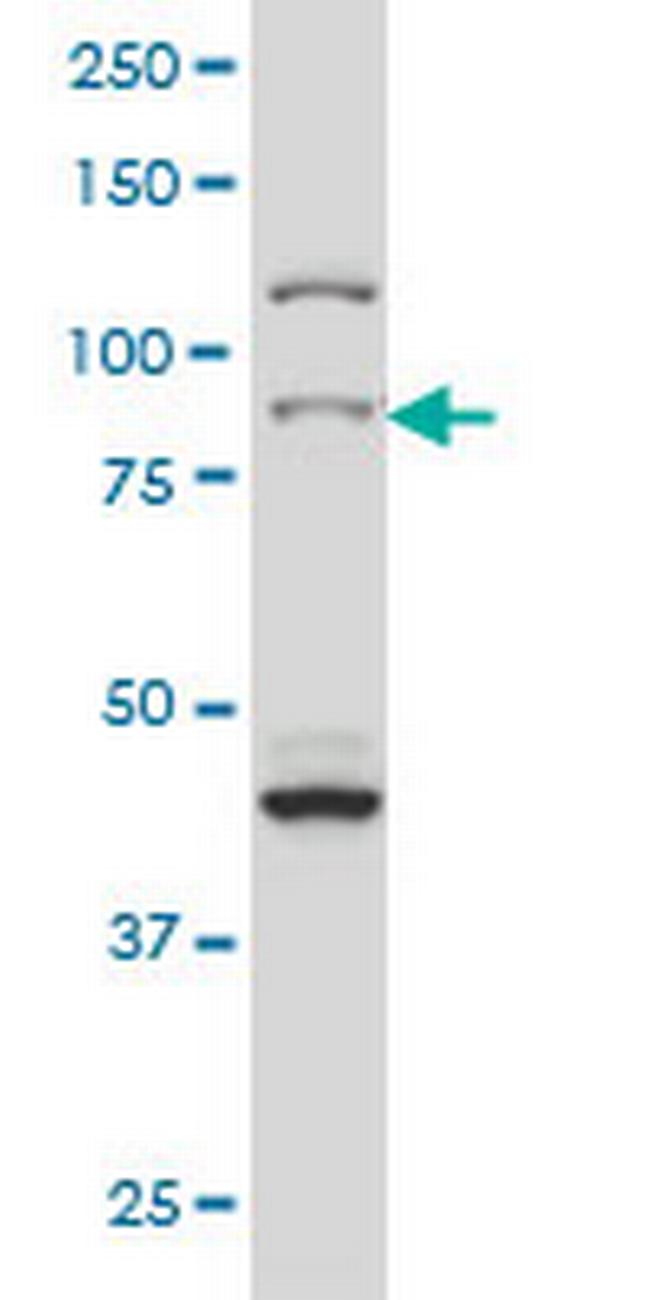 RPS6KA2 Antibody in Western Blot (WB)