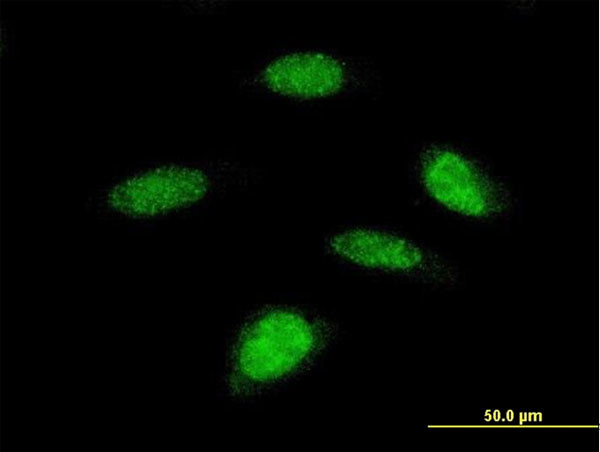 RPS6KB2 Antibody in Immunocytochemistry (ICC/IF)