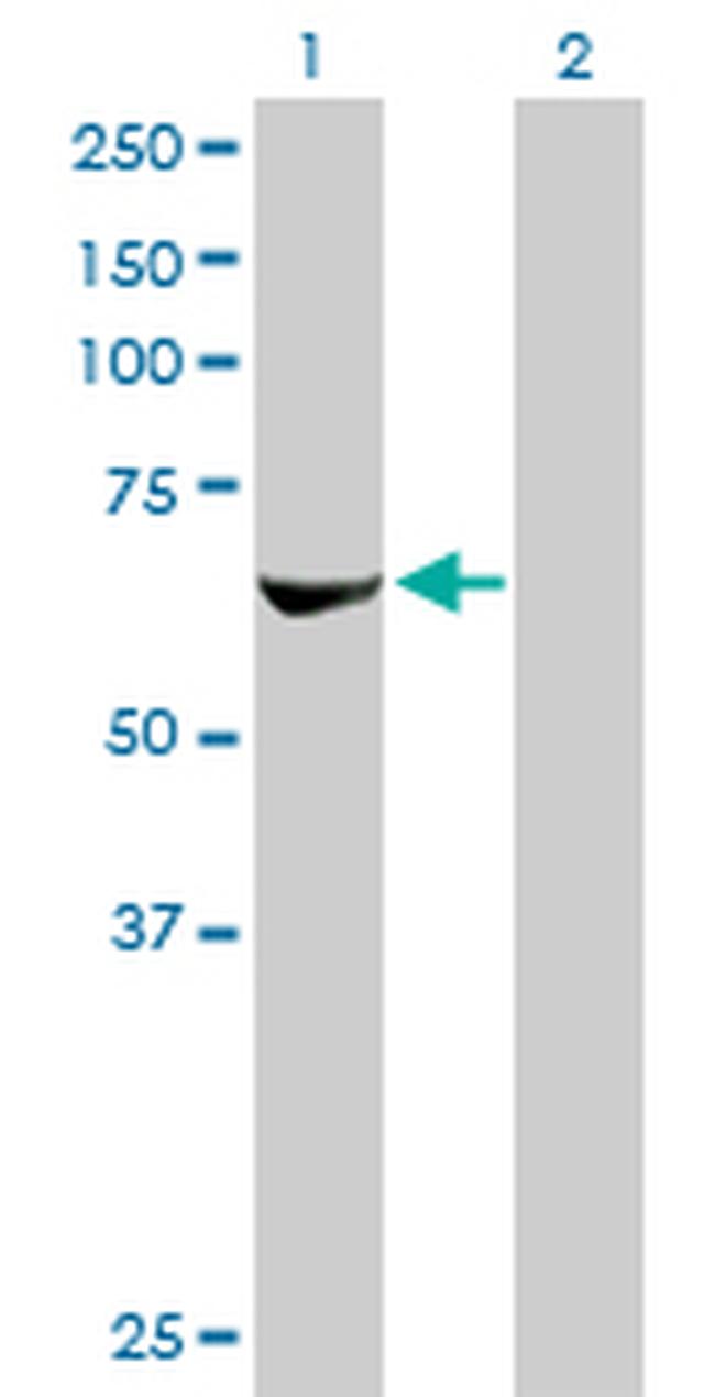 RPS6KB2 Antibody in Western Blot (WB)