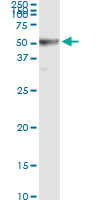 RRM2 Antibody in Immunoprecipitation (IP)