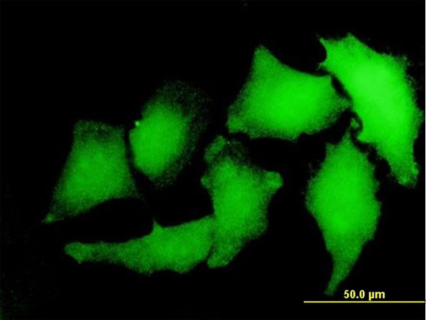 S100A2 Antibody in Immunocytochemistry (ICC/IF)