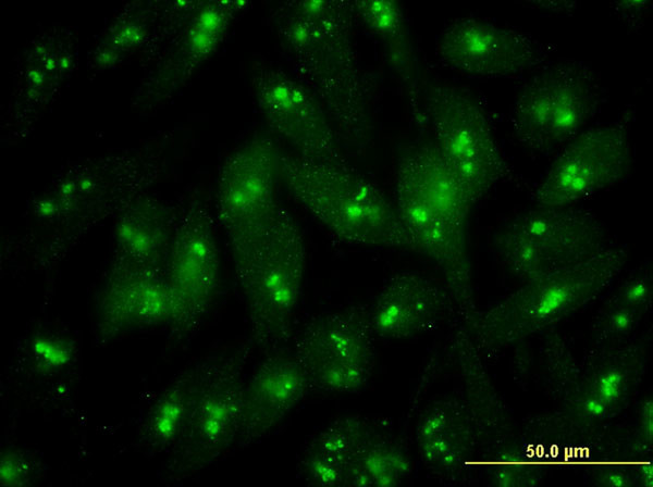 S100B Antibody in Immunocytochemistry (ICC/IF)