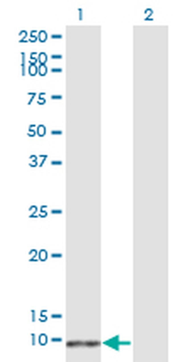 S100B Antibody in Western Blot (WB)