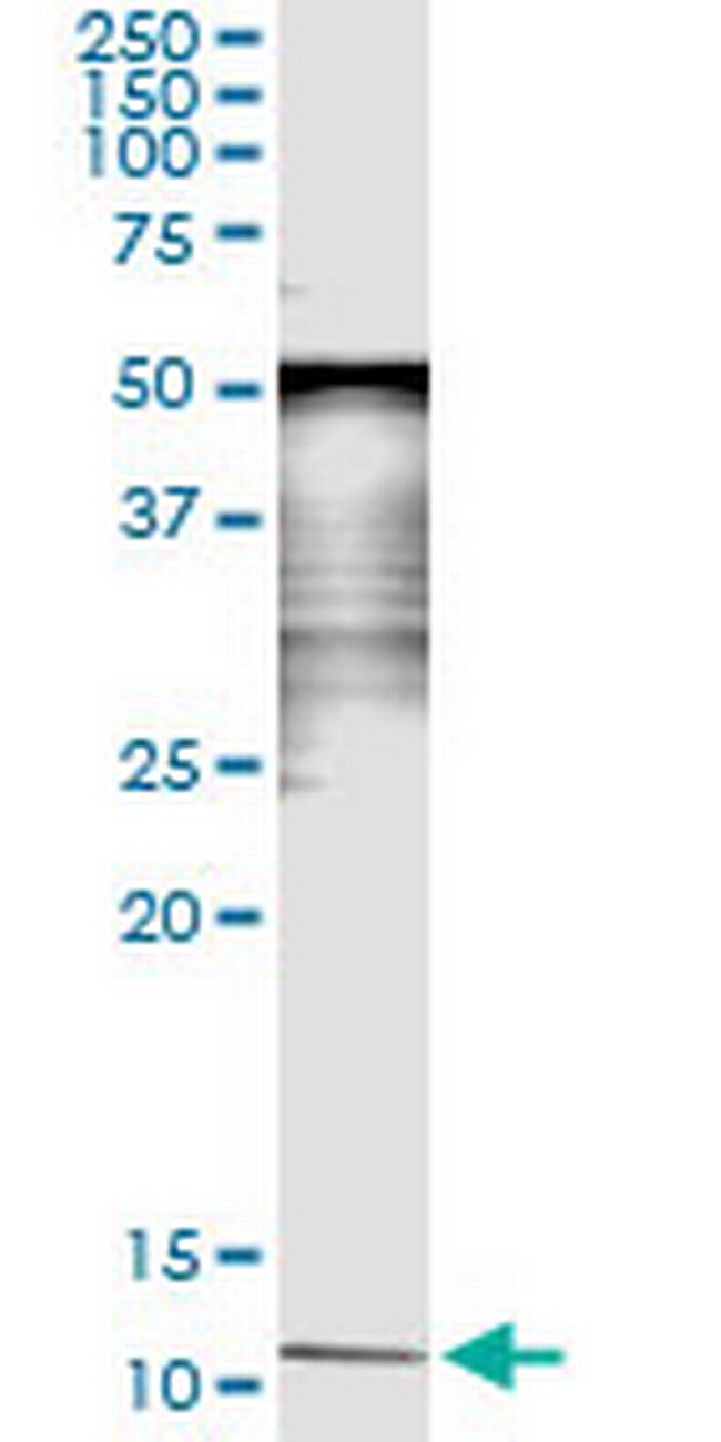 SAA4 Antibody in Immunoprecipitation (IP)