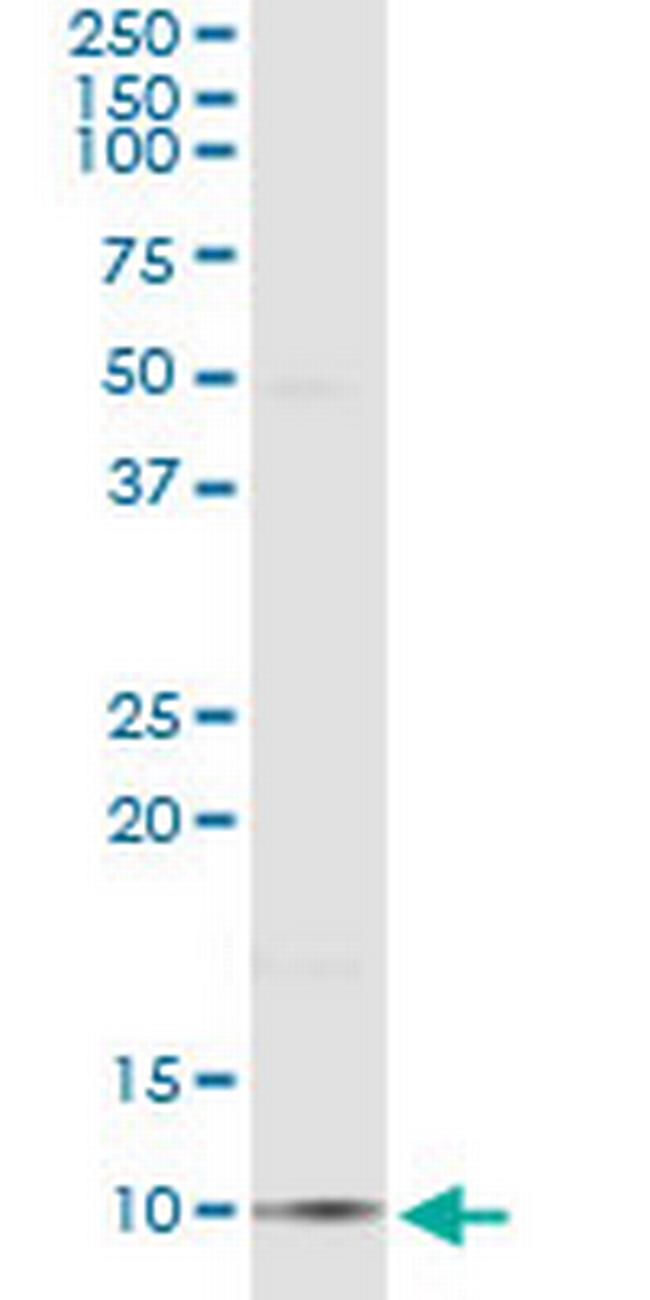 CCL18 Antibody in Immunoprecipitation (IP)