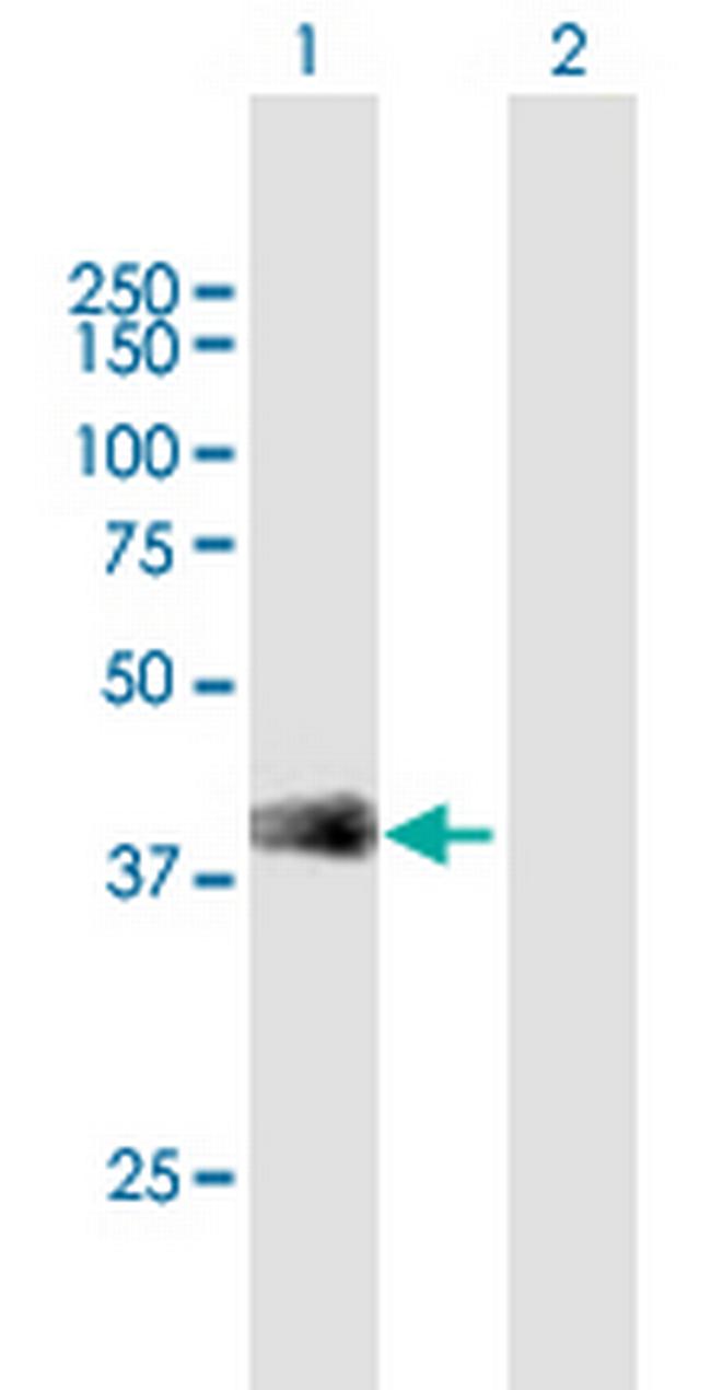 SFTPB Antibody in Western Blot (WB)