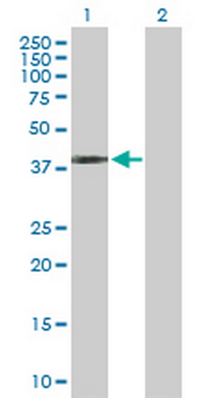 SFTPB Antibody in Western Blot (WB)