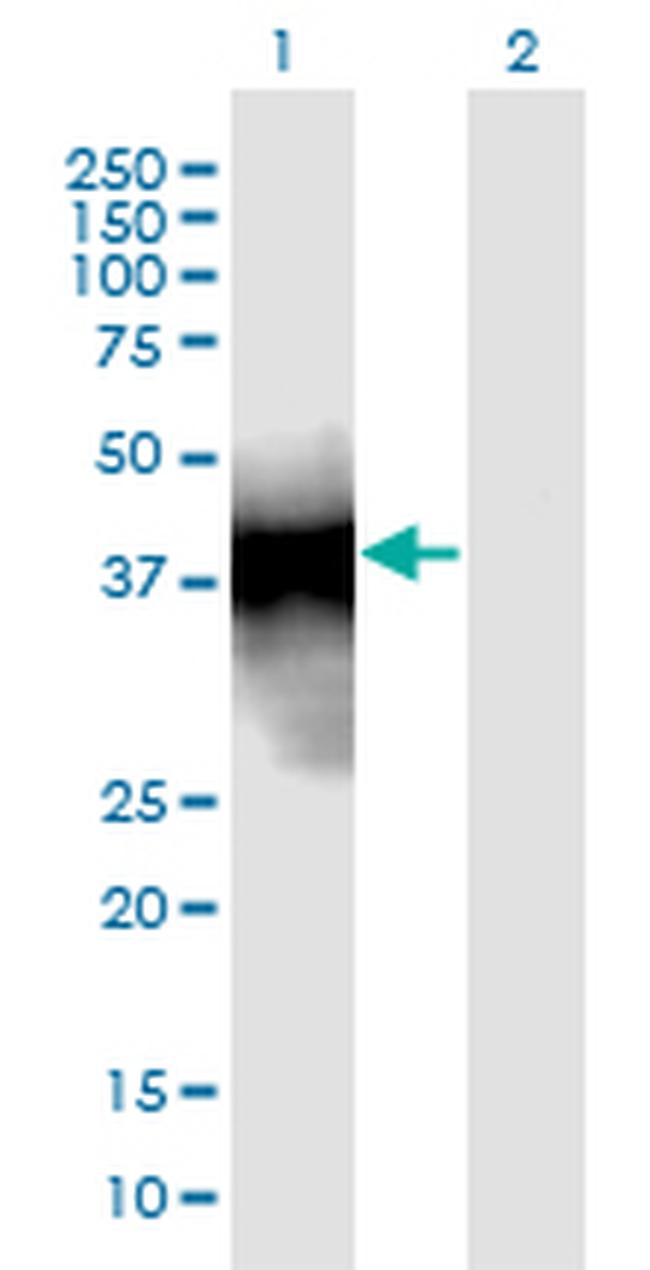 SFTPB Antibody in Western Blot (WB)