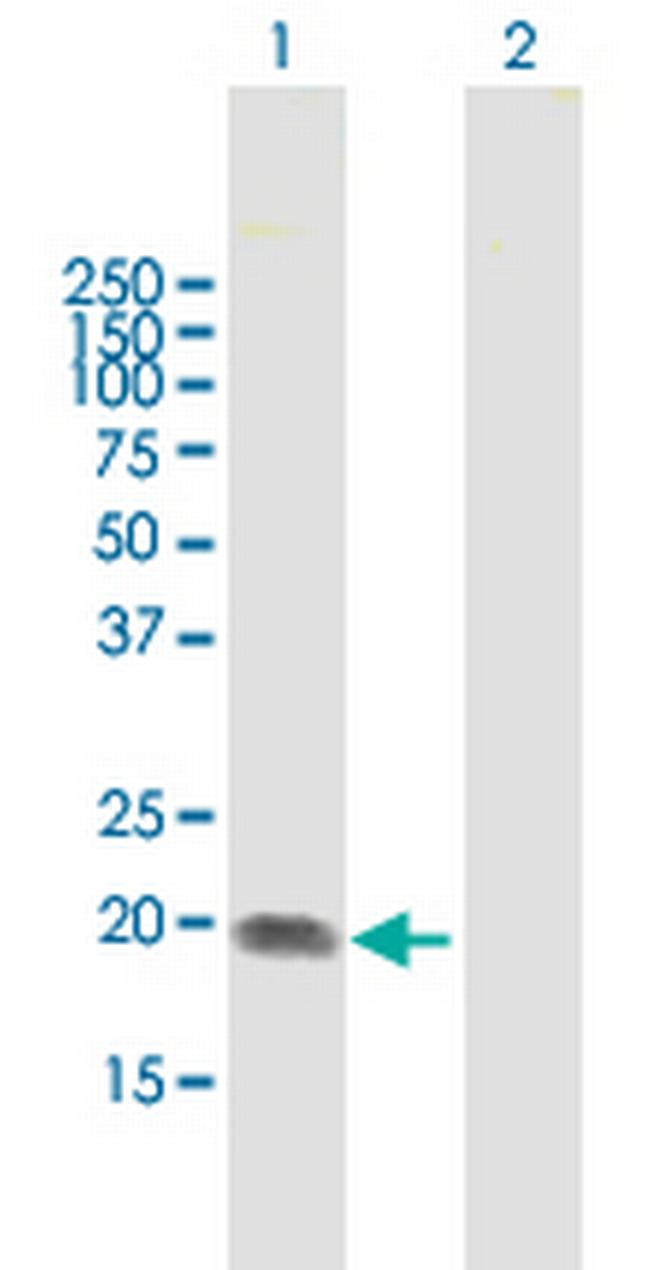 ST6GAL1 Antibody in Western Blot (WB)