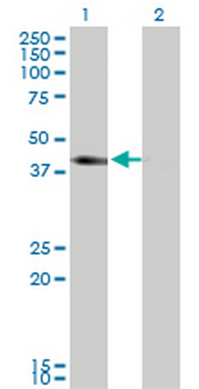 SLC12A1 Antibody in Western Blot (WB)