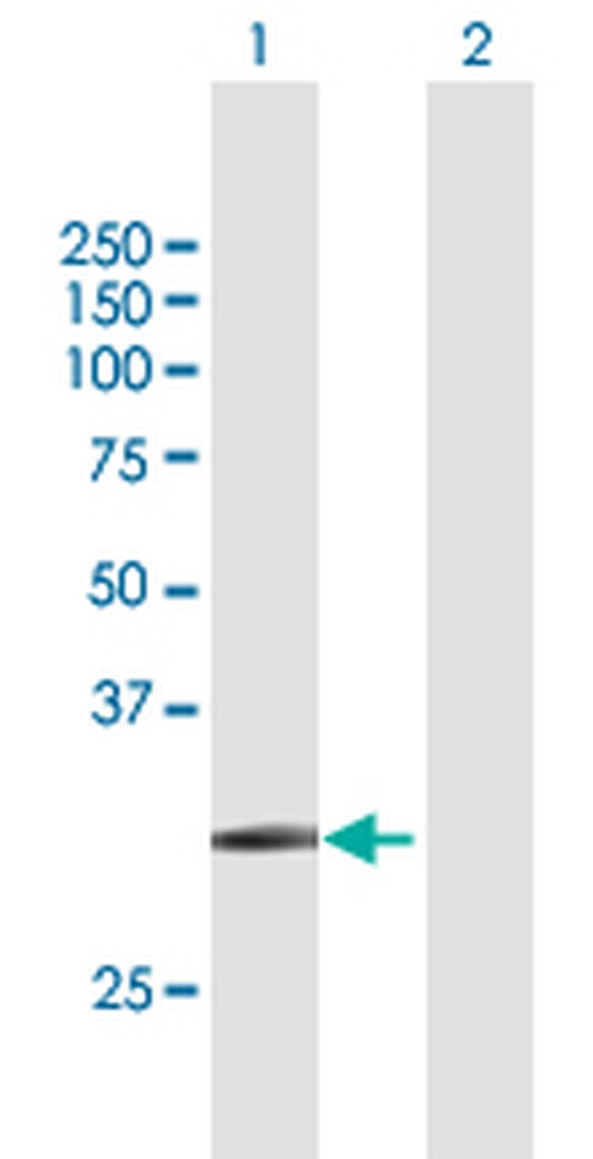 SLC14A1 Antibody in Western Blot (WB)