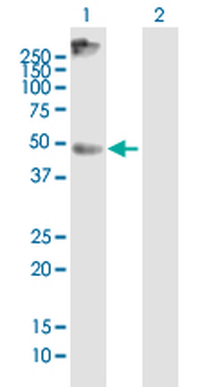 SLC16A1 Antibody in Western Blot (WB)