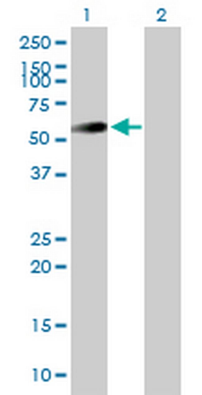 UAP1 Antibody in Western Blot (WB)