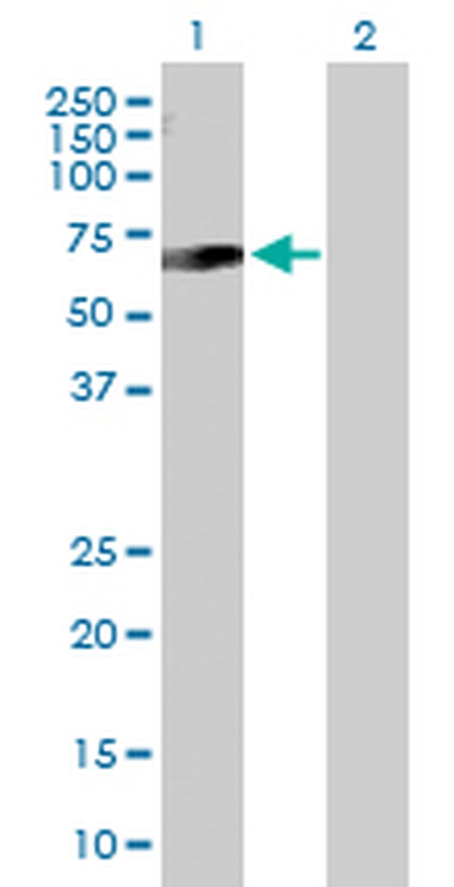 SSTR5 Antibody in Western Blot (WB)