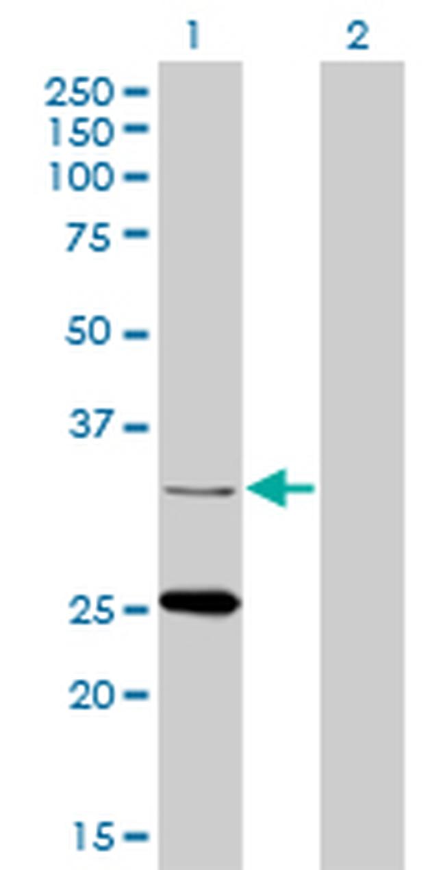 STAR Antibody in Western Blot (WB)