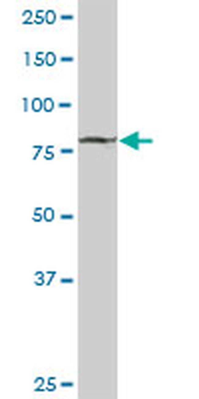 STAT1 Antibody in Western Blot (WB)