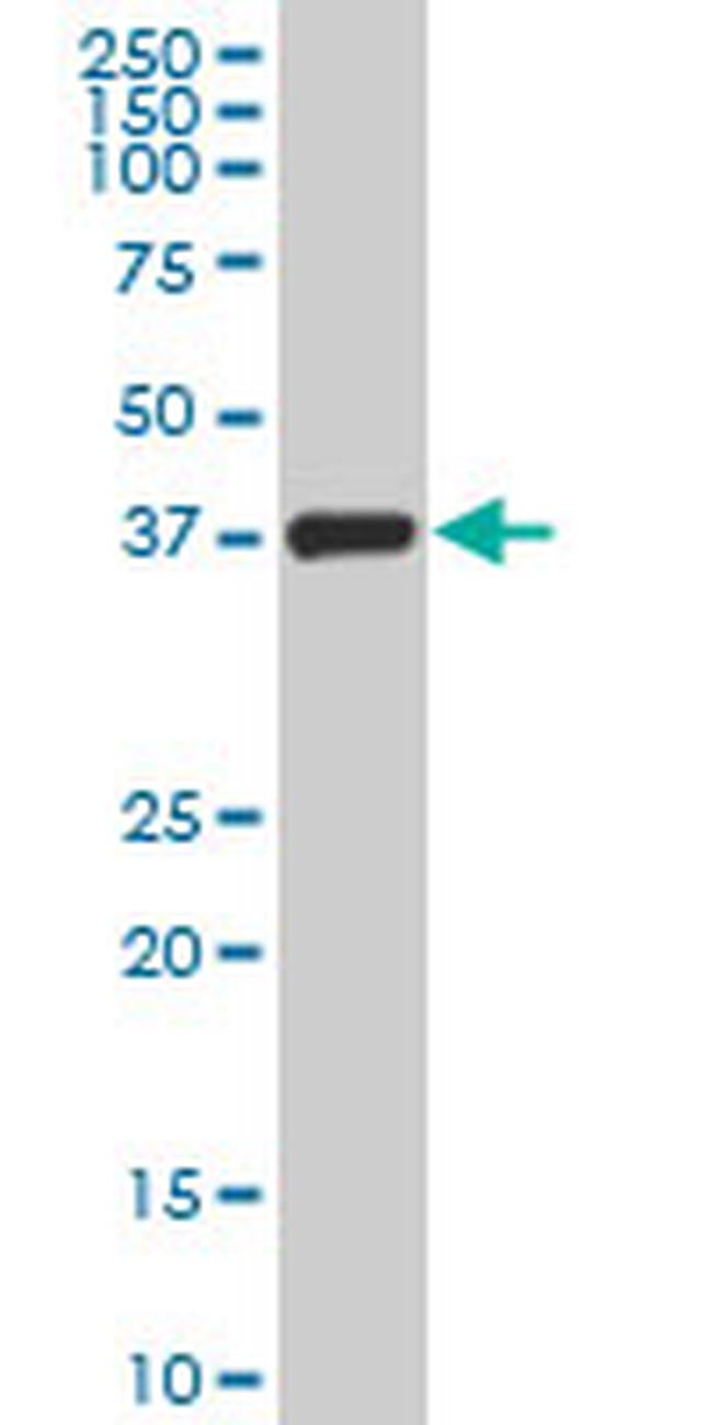 TCEA3 Antibody in Western Blot (WB)