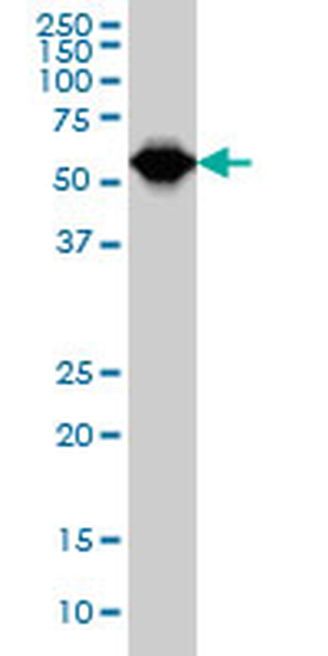 TCF3 Antibody in Western Blot (WB)